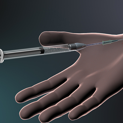 Gastric Procedure – Medical animation
