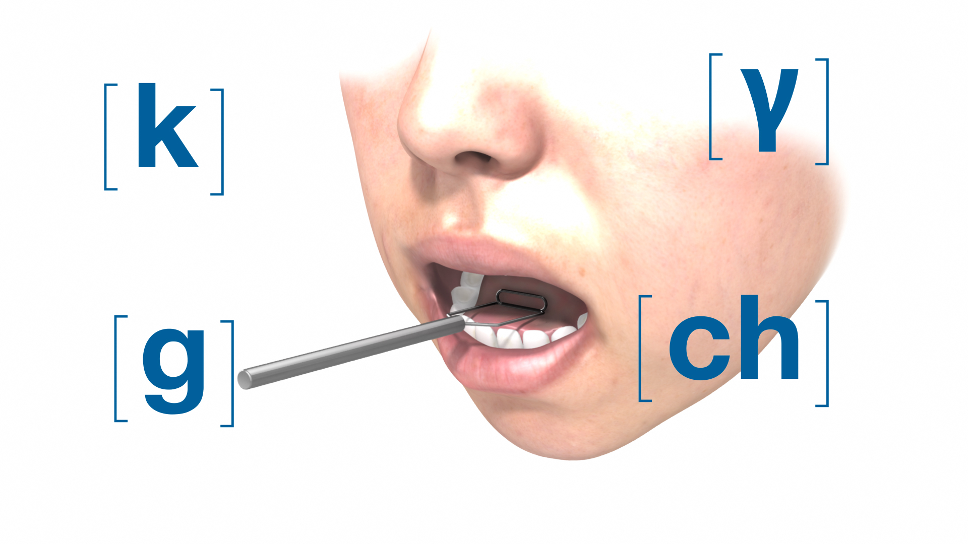 Speech Sondes – Medical animation